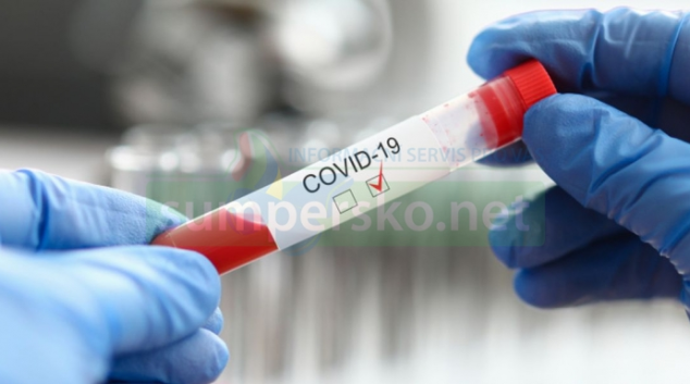 FN Olomouc přidává druhé odběrové místo na vyšetření COVID-19