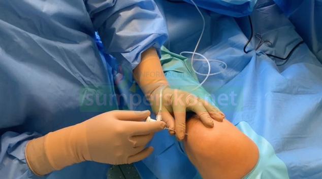 Nanoskopie pomůže zjistit, co se děje kolenním kloubu