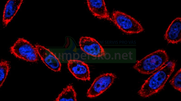 Objev otevírá cestu k přesnější diagnostice a léčbě nádorů