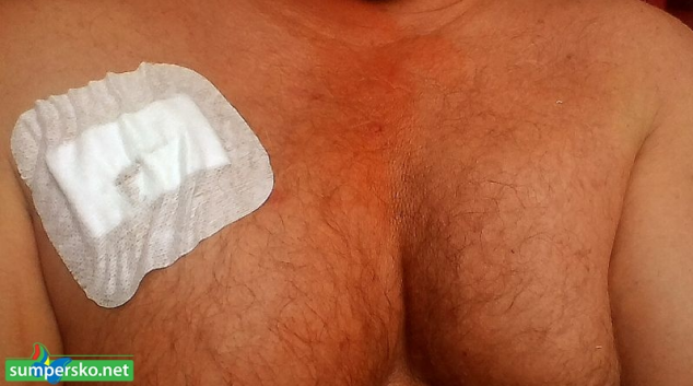 Muž sekal trávu a skončil na operačním stole