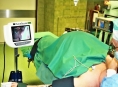 Anesteziologové v Šumperku mají špičkového pomocníka