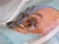 Na Světový den zraku vyšetří lékaři šumperské nemocnice oči zdarma