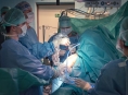 Nová operační technika pomáhá ortopedům v Olomouci navrátit hybnost ramene