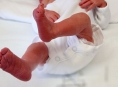 V Nemocnici Šumperk se v loňském roce narodilo devět set jedenáct dětí