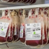 V Jesenické nemocnici je nejžádanější krevní skupina O Rh D negativní   zdroj foto: R. Miloševská - Agel