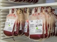 Šumperská transfúzní služba stabilizuje zásoby krve