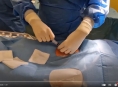 VIDEO. Kardiologové z FN Olomouc zavádějí pacientům bezelektrodové kardiostimulátory