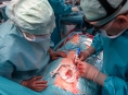 Moderní kardiochirurgie s rychlejším návratem do života