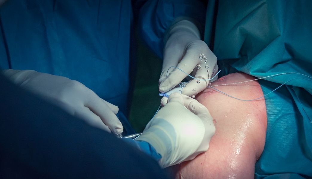 nová operační technika pomáhá ortopedům navrátit hybnost ramene zdroj foto: FNOL